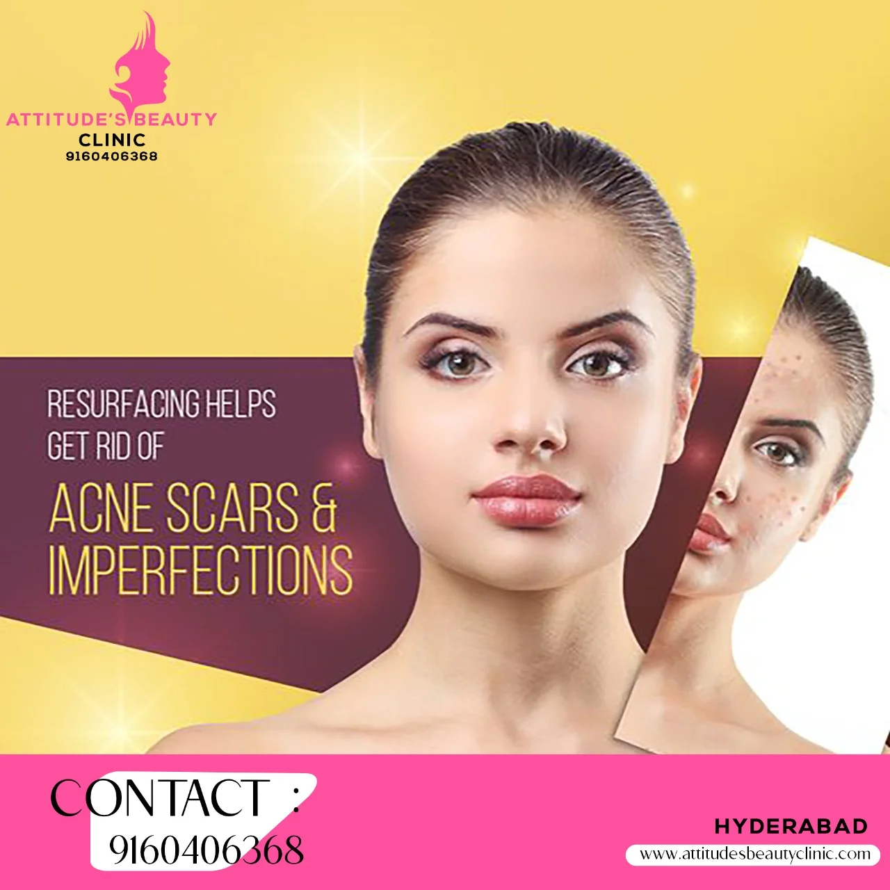 SKIN TREATMENT