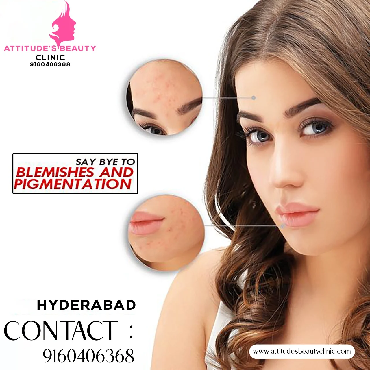 SKIN TREATMENT